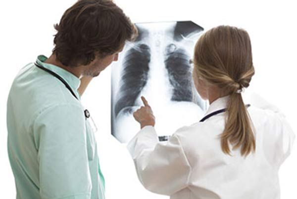 Kræftscreening af aldrig-rygere i Taiwan viser markante resultater